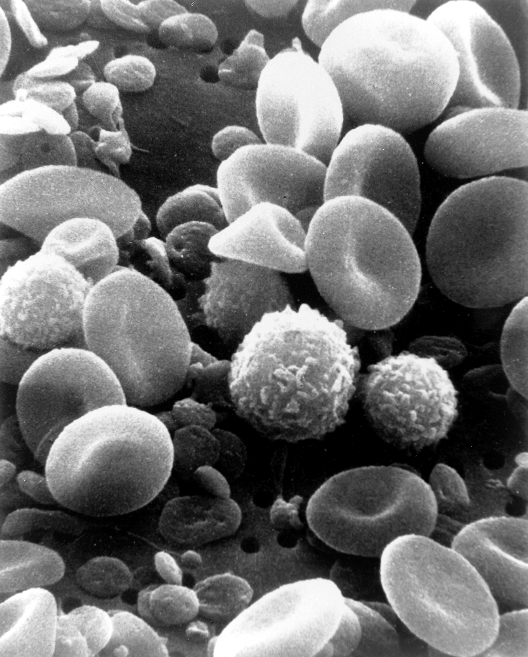 SEM_blood_cells